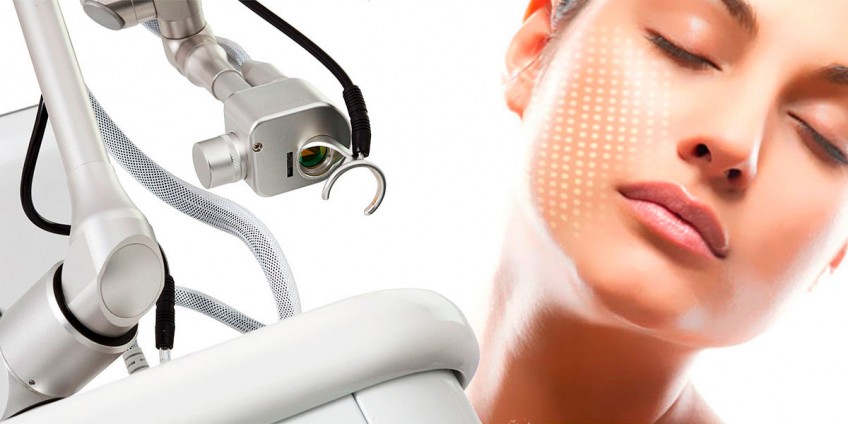 Fractional laser in cosmetology: essence, advantages, and disadvantages of the method