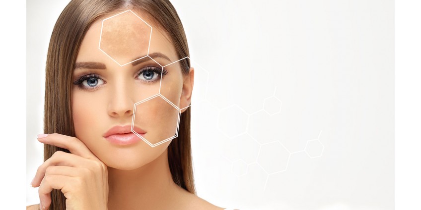 Mesotherapy: Needles or No Needles. Comparing Effectiveness and Comfort