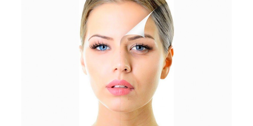 The best ways to get rid of expression lines
