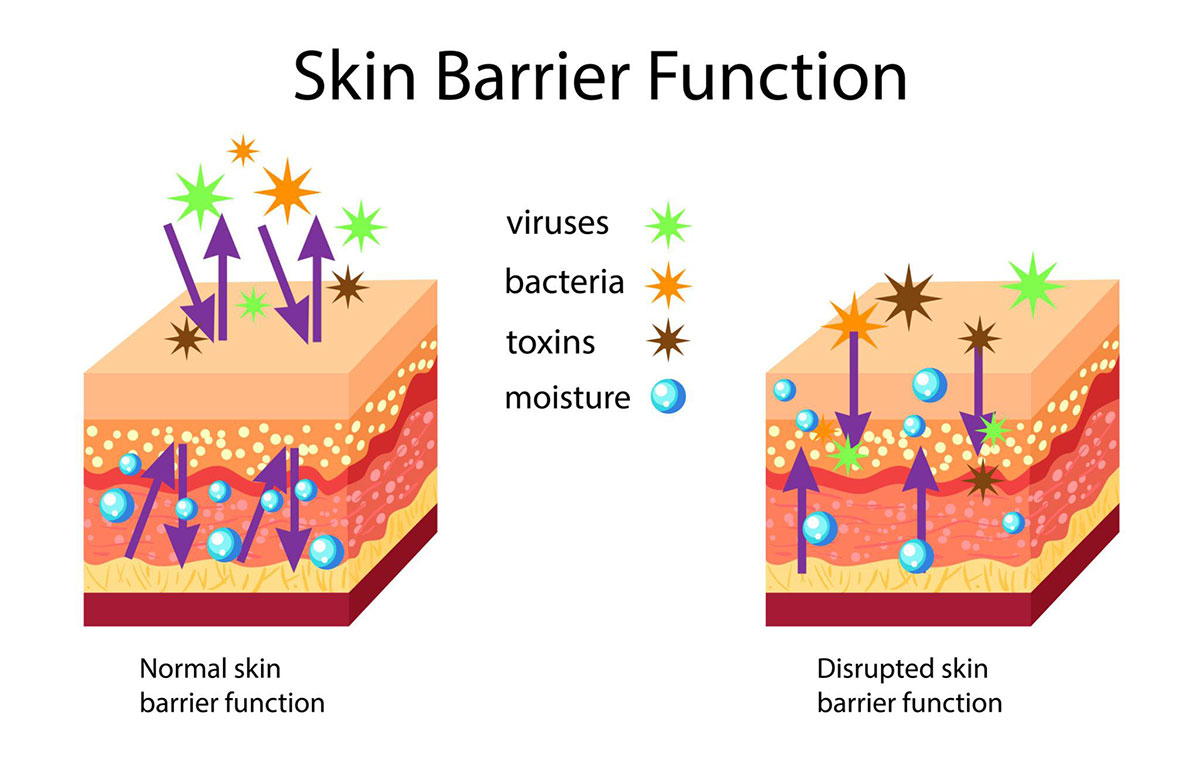 what an impaired skin barrier is and why it is a problem