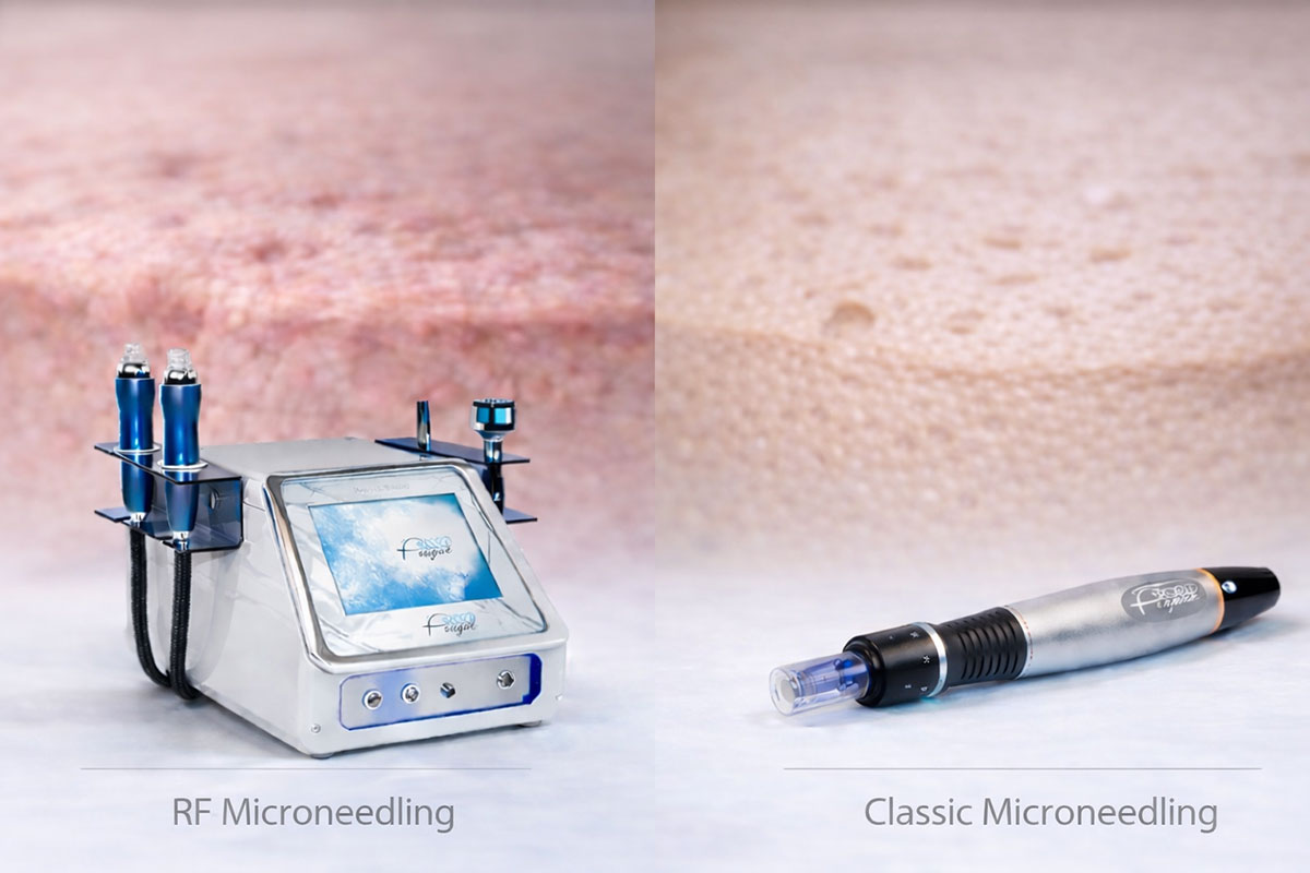 RF microneedling or traditional microneedling